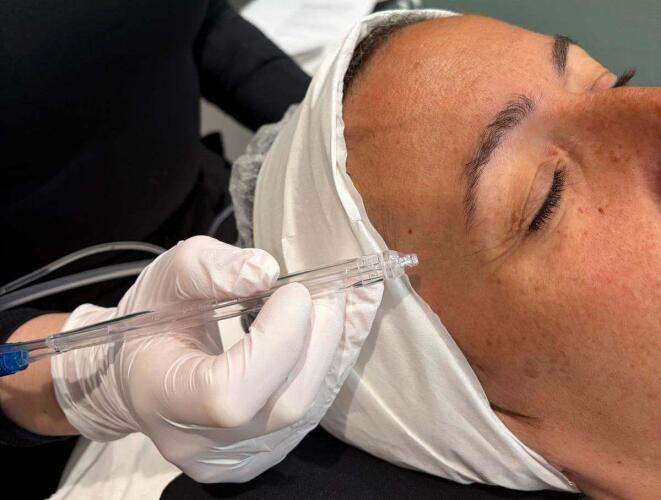 Laserel : les soins esthétiques non invasifs s’intègrent de plus en plus au quotidien