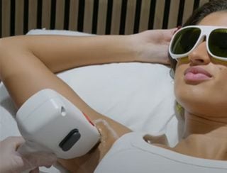 Smart Duck : séance d'épilation laser 1 - 